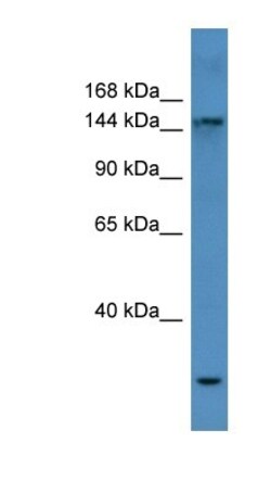 COL4A3 Antibody, Novus Biologicals 20&mu;L; Unlabeled:Antibodies, Polyclonal